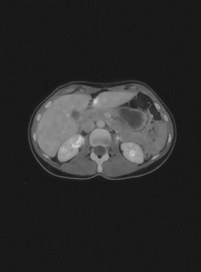 Medical PET-CT scan