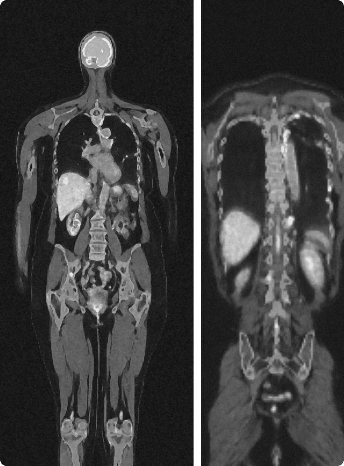 Medical PET-CT scan