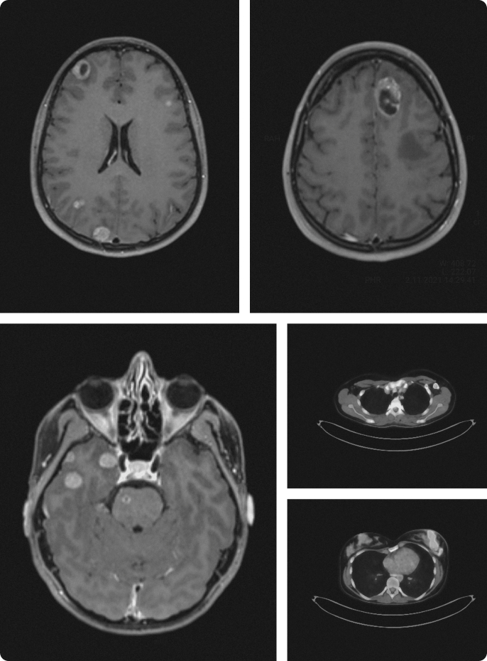Medical PET-CT scan