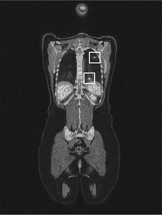 Medical scan of Anna F.
