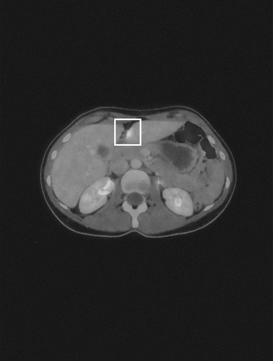 Medical scan of Aselia R.