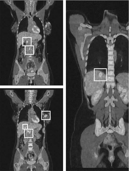 Medical scan of Céline L.