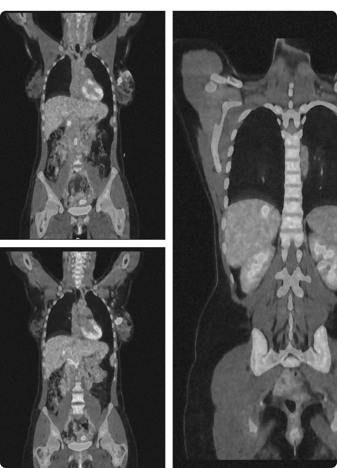 Medical PET-CT scan