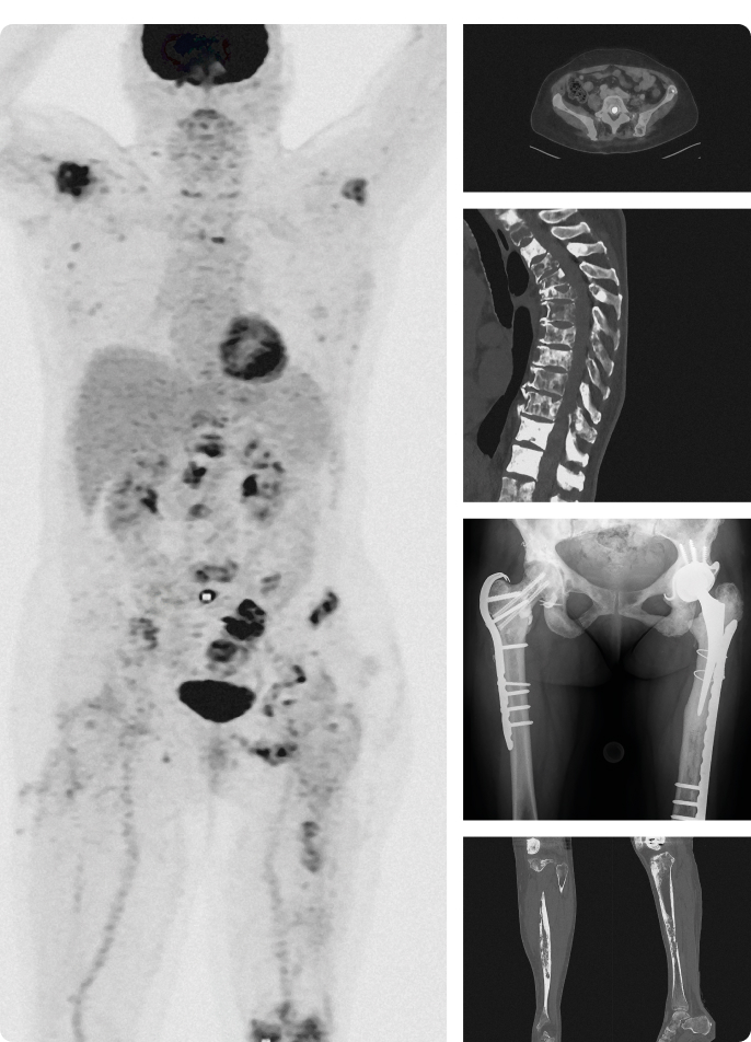 Medical PET-CT scan