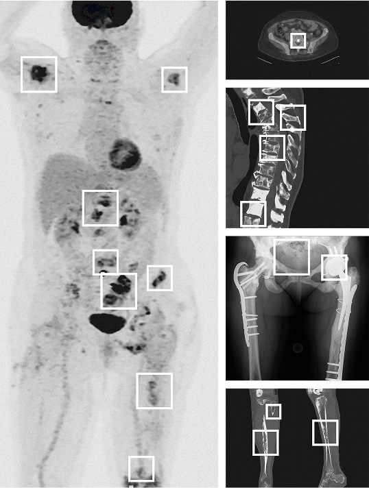 Medical scan of Daniela S.