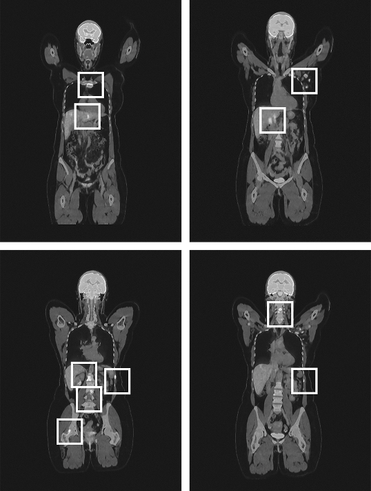 Medical scan of Julia B.