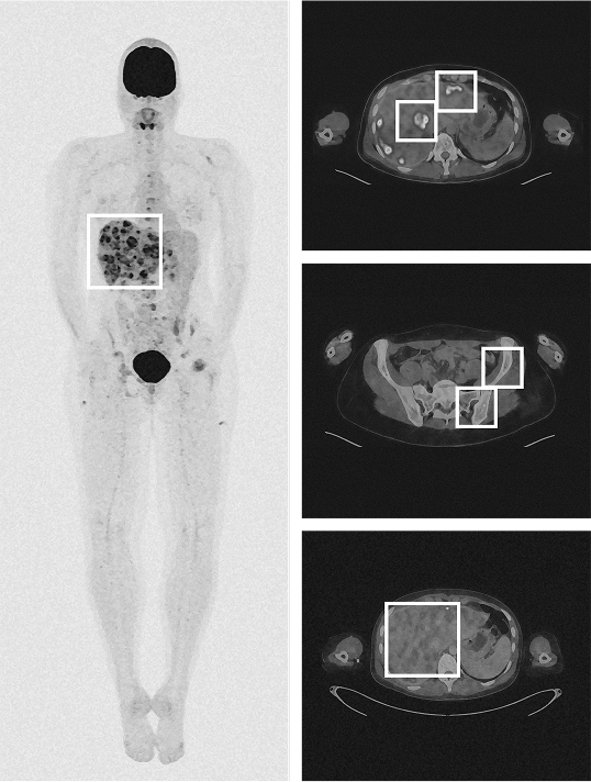 Medical scan of Julia Z.