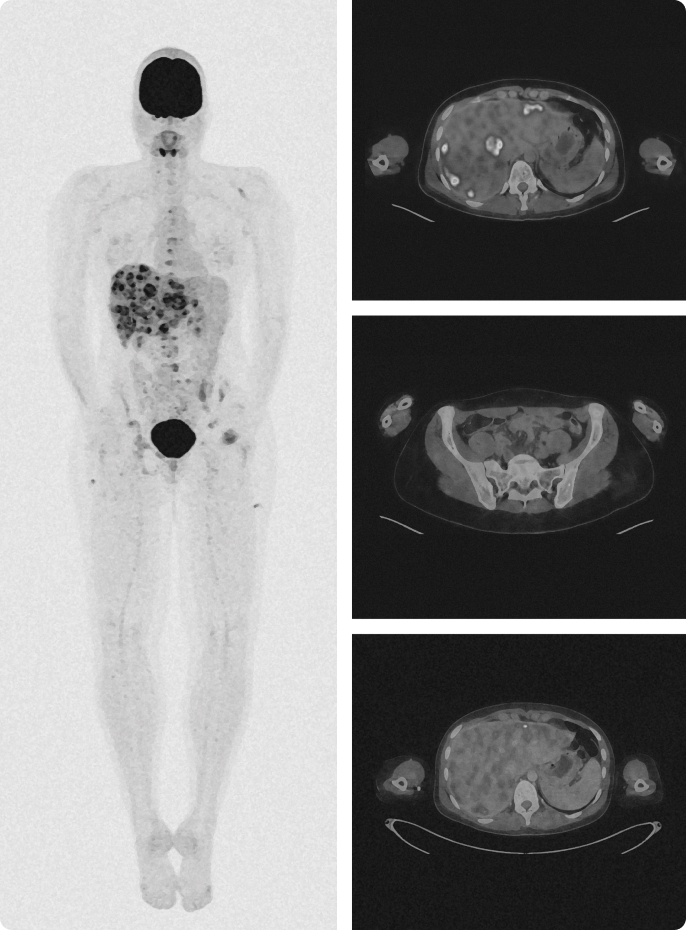 Medical PET-CT scan