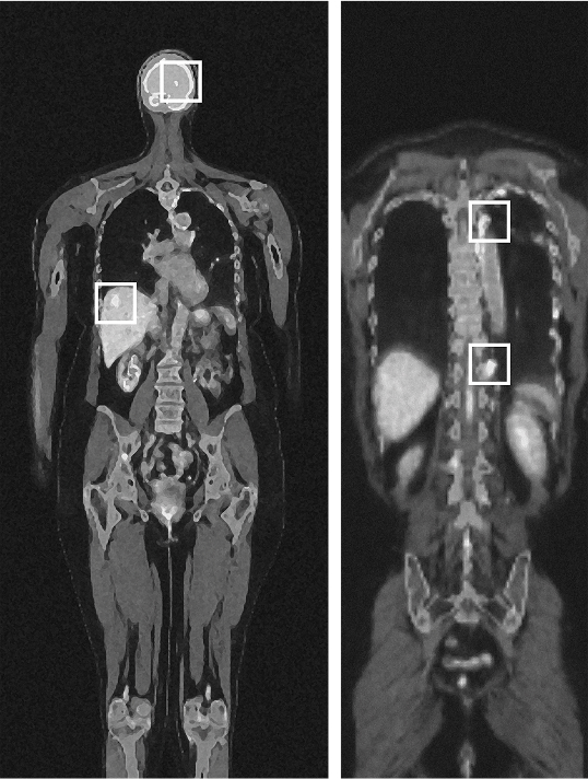 Medical scan of Marina M.