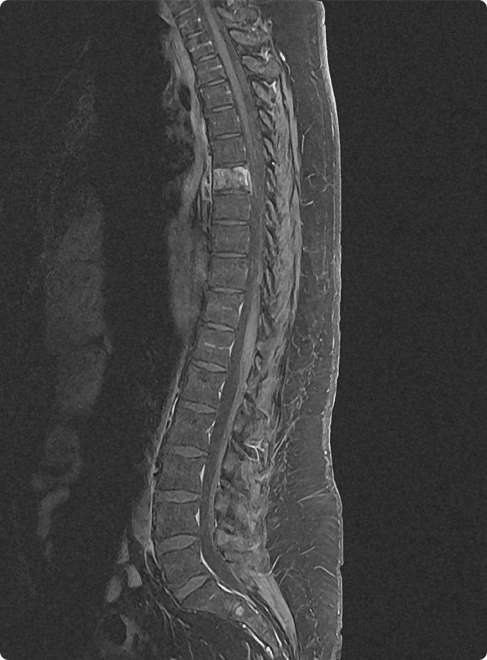Medical PET-CT scan