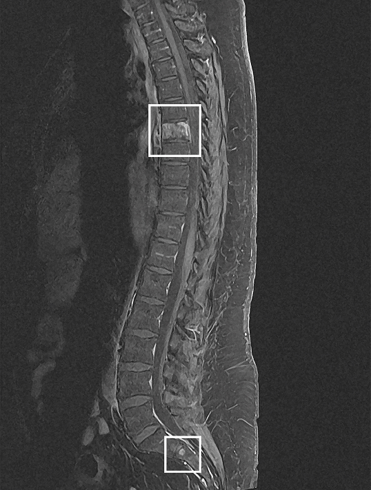 Medical scan of Melanie V.