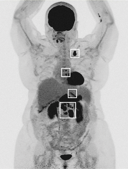 Medical scan of Patricia K.