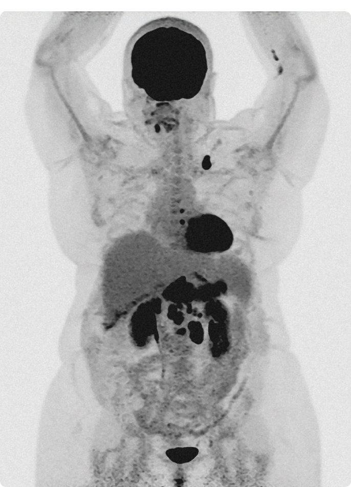 Medical PET-CT scan