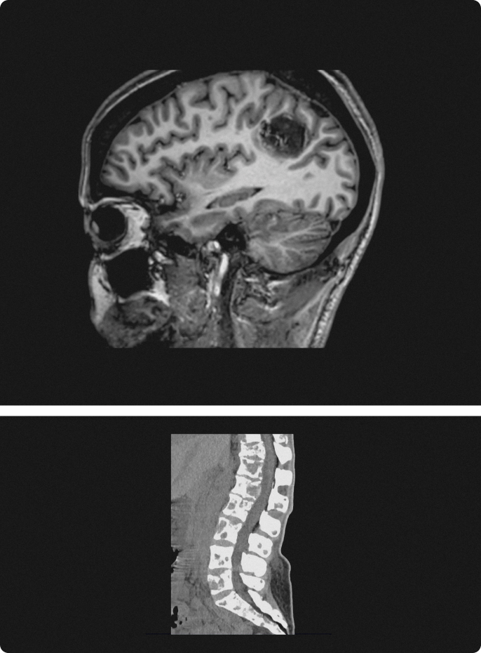 Medical PET-CT scan