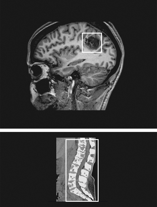 Medical scan of Petra W.