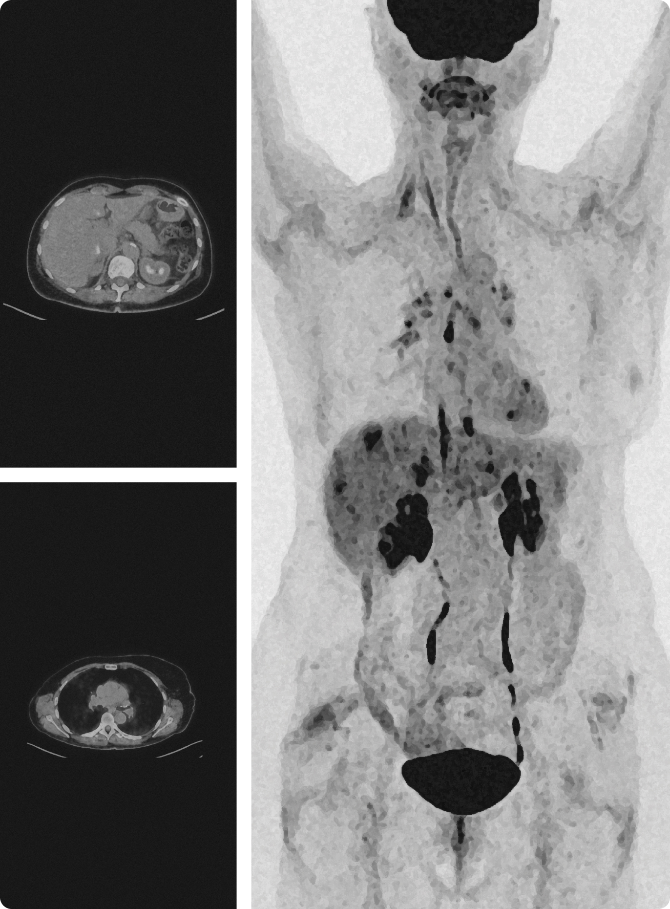 Medical PET-CT scan