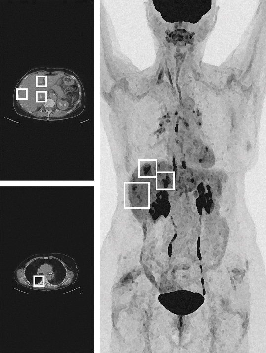 Medical scan of Susanne R.