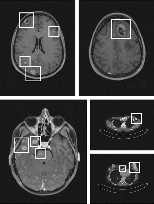 Medical scan of Tanja B.